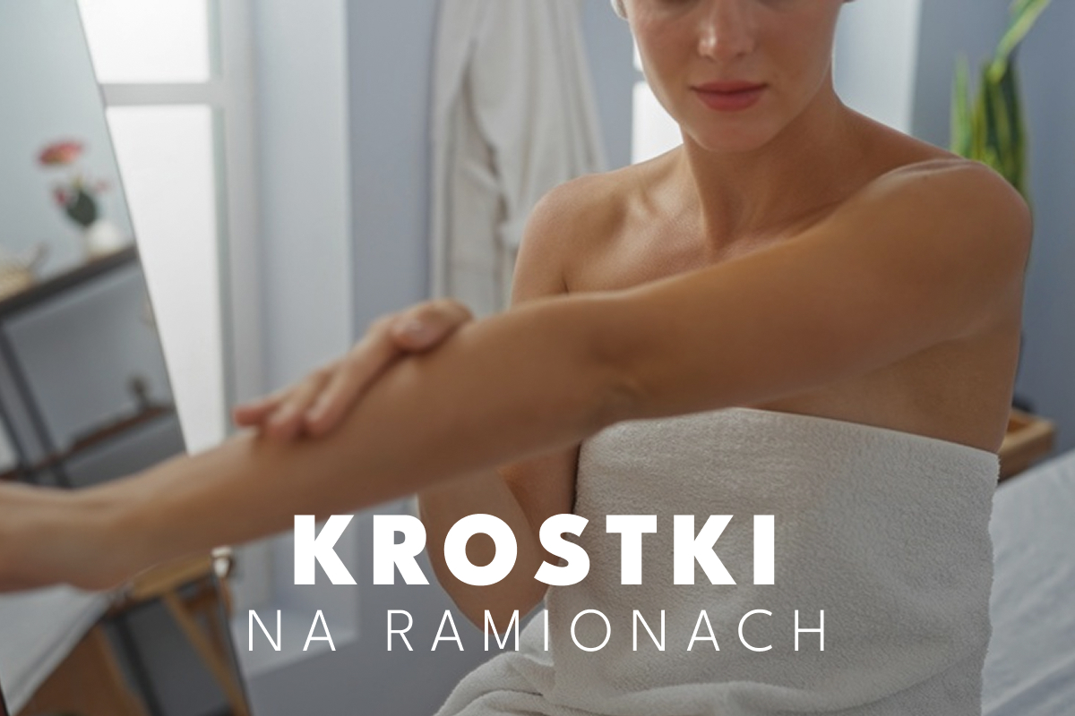 Masz krostki na ramionach? Podpowiemy Ci, jak się ich pozbyć! Masz krostki na ramionach? Podpowiemy Ci, jak się ich pozbyć!