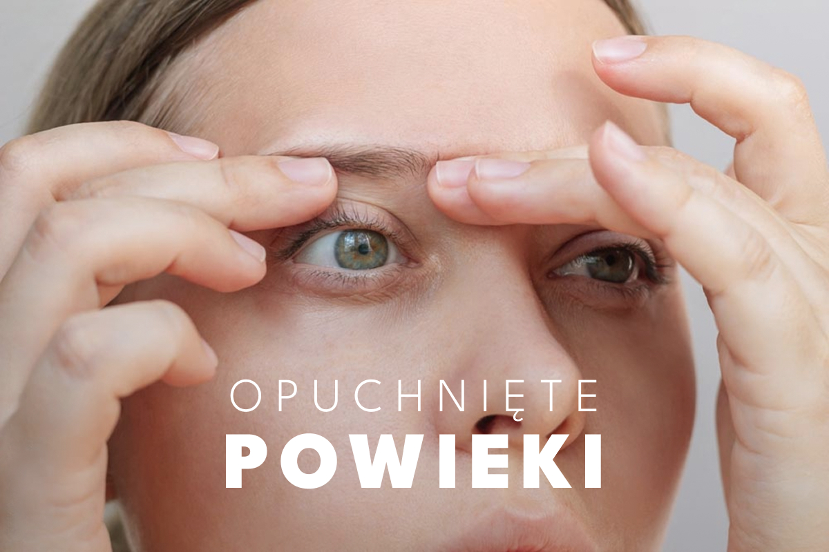 Co na opuchnięte powieki? Płatki, kremy i domowe triki na obrzęk Co na opuchnięte powieki? Płatki, kremy i domowe triki na obrzęk