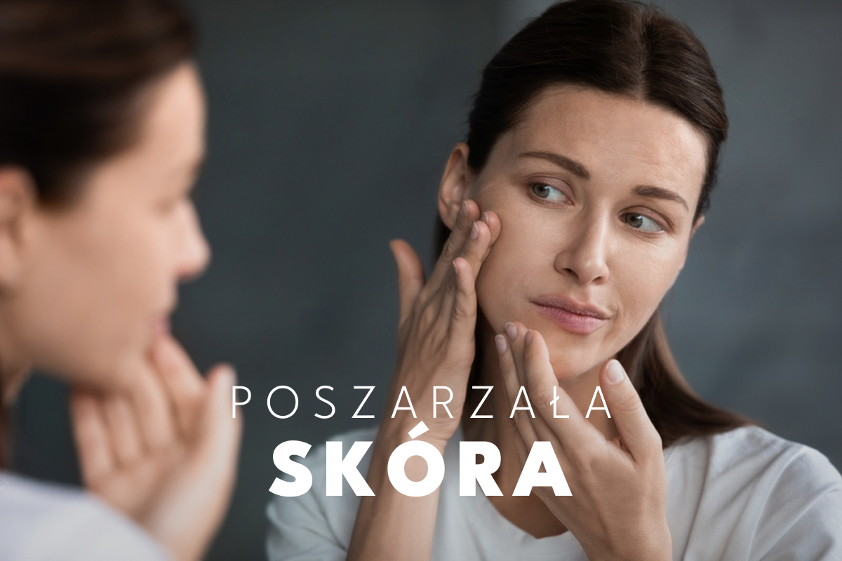 Szara cera zimą – 6 sposobów na przywrócenie skórze blasku