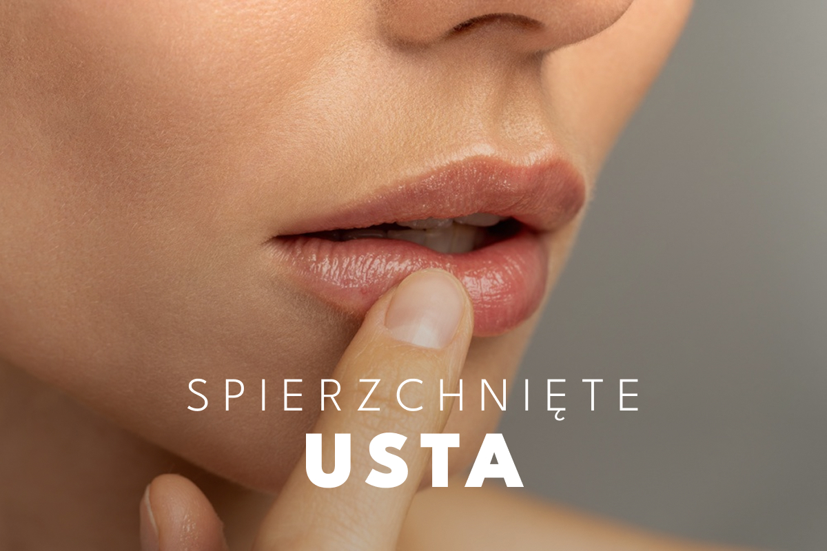 Spierzchnięte usta – pielęgnacja warg zimą
