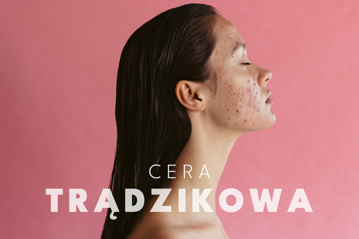 Codzienna pielęgnacja twarzy trądzikowej. Sprawdź!