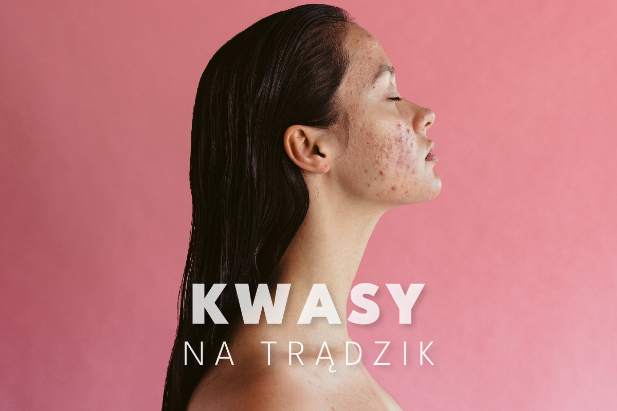 Jakie kwasy na trądzik? Sprawdź skuteczne rozwiązania w walce z problemami skórnymi